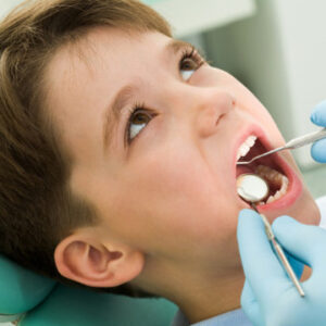 sealants